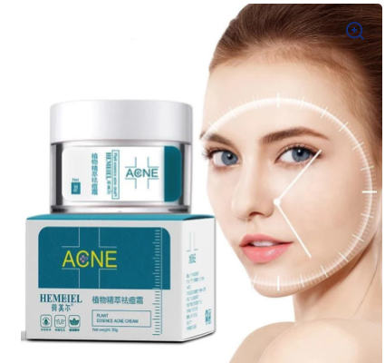 Acne Cream